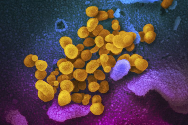 Células de coronavirus, indicadas en amarillo, saliendo de la superficie de células marcadas con azul y rosado, en esta foto de microscopio suministrada por los Institutos Nacionales de Salud de Estados Unidos, en febrero de 2020. (NIAID-RML via AP)